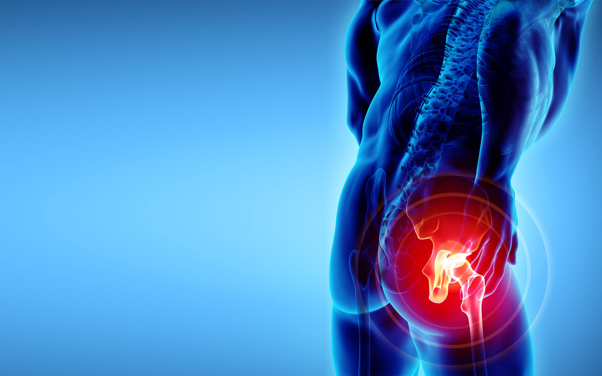 Avascular Necrosis or Osteonecrosis Symptoms Treatment Options