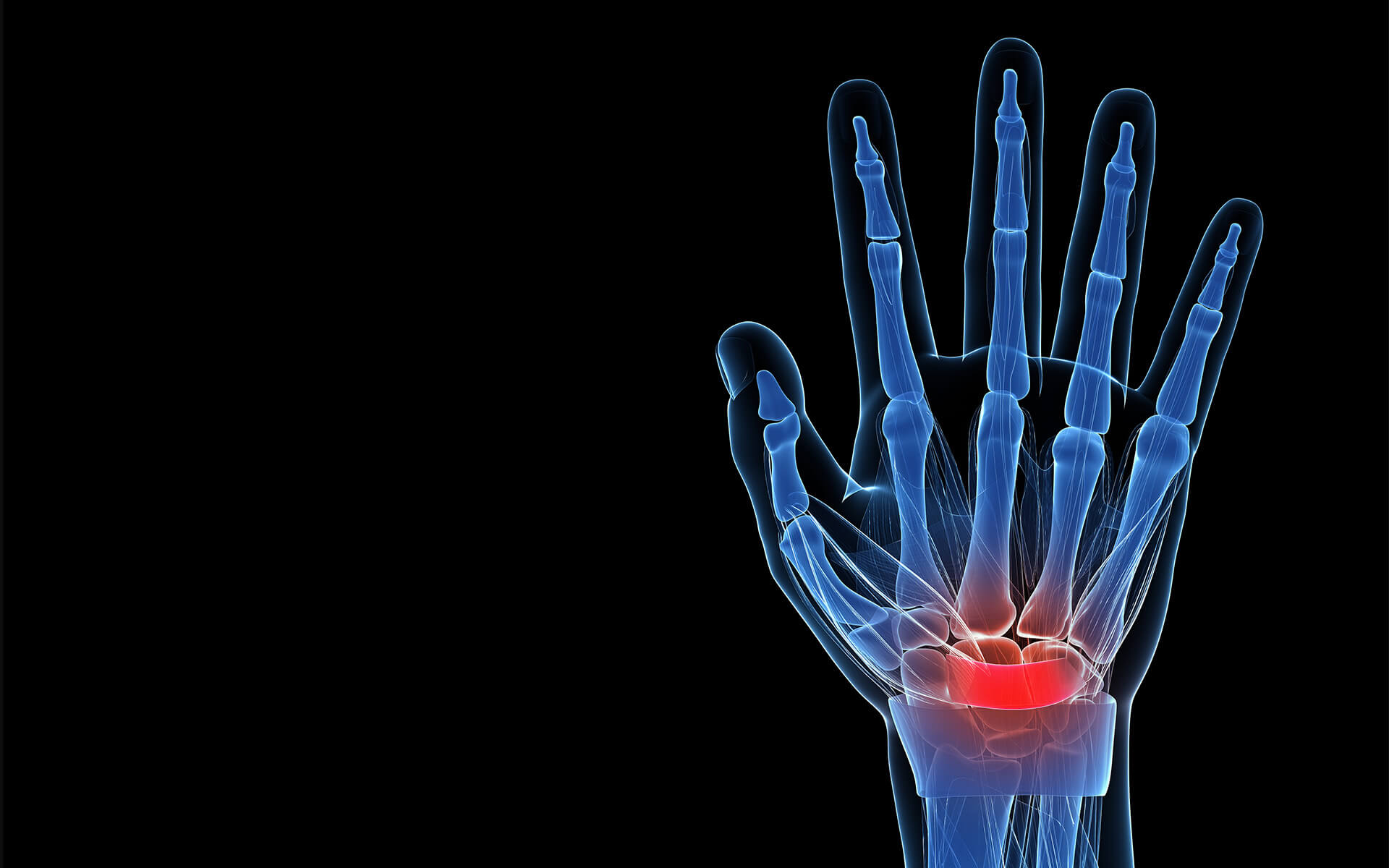 Understanding the 3 Types of Neuropathy: Symptoms & Causes | IFAR