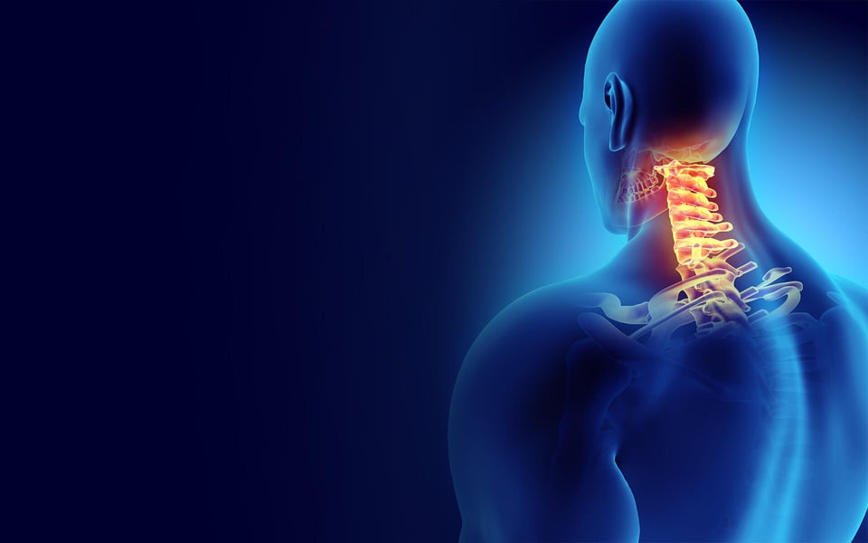 Understanding Occipital Neuralgia | Nerve-Induced Headaches