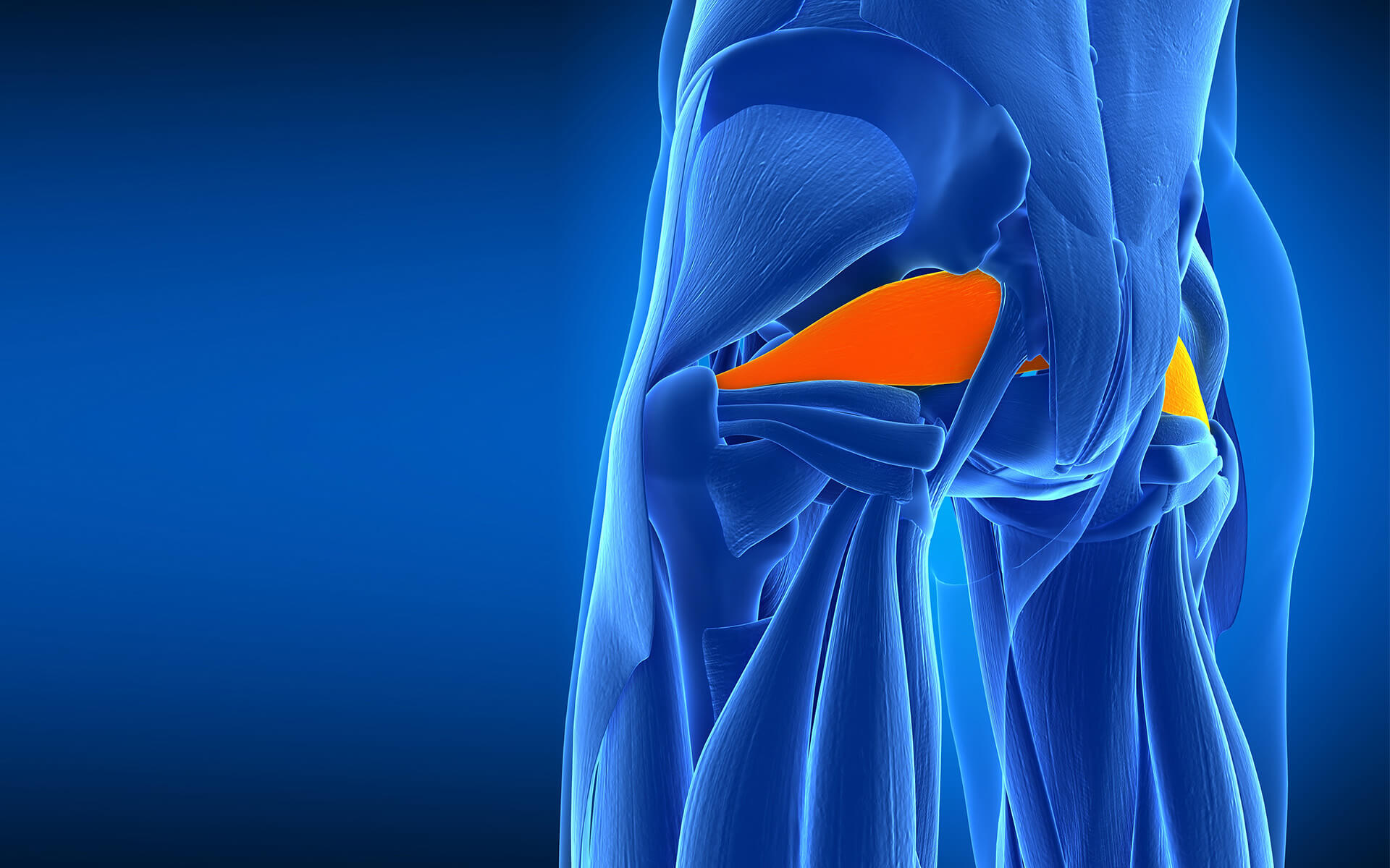 Piriformis Syndrome Overview Symptoms Diagnosis Treatments IFAR