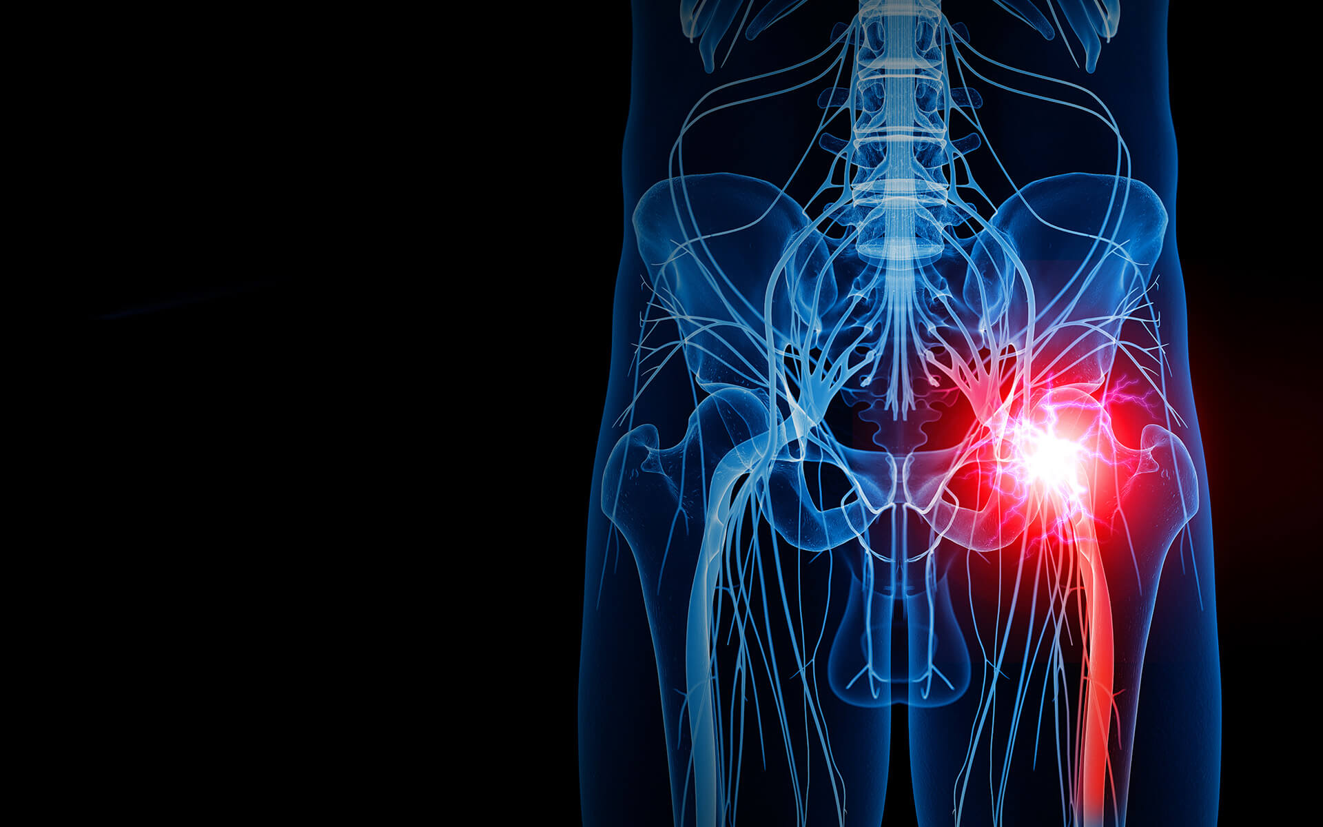 Pudendal Neuralgia Causes Symptoms Diagnosis IFAR